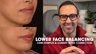 Non-Surgical Lower Face Balancing | Dr. Kian