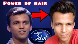 HIGH DENSITY|Front hair|line| Regrowth|TRANSPLANT|patch|fall|MINOXIDIL|FINASTERIDE|results|hindi