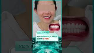 Phục hình toàn hàm răng sứ Cercon Vita - Nha khoa Sài Gòn Yo's Dental   #nhakhoasaigon #yosdental