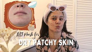 DIY Face mask for Dry Skin | Simran Sandal