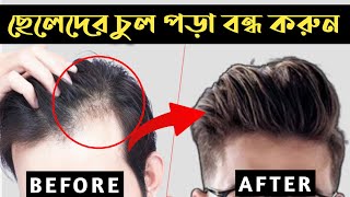 ছেলেদের চুল পড়া বন্ধ করুন 🔥 How To Stop Hair Fall For Men | ছেলেদের চুল পড়ার সমাধান