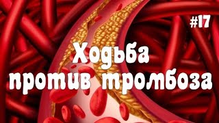 17. Ходите против тромбоза