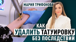 Удаление тату: как избавиться от ошибок молодости? #тату #удалениетатуировок