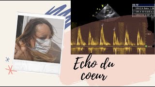 { #VLOG 26 } : A l’hôpital pour une échographie du coeur.