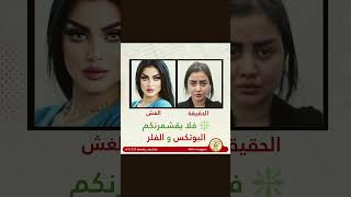 فلا يقشمرنكم البوتكس و الفلر #ام_اللول#اكسبلور#العراق#جمهورية_حناطة