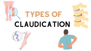 Types Of Claudication