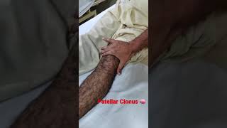 Knee Clonus 🧠 #shorts  #neurology  #shortsyoutube 🧠🧠