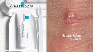 Cicaplast Baume B5+ | Anti-Marks Efficacy