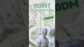 POINT D’ACUPUNCTURE - 20DM / Bai Hui #acupuncture #acupuncturepoints #medecinechinoise