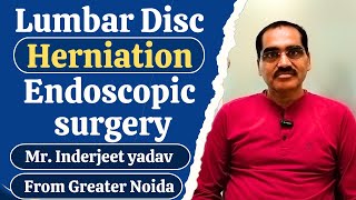 Lumbar disc herniation endoscopic surgery |  Spine Surgery In Delhi NCR