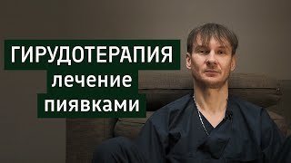 Гирудотерапия: лечение пиявками | отзывы | противопоказания | рекомендации к применению