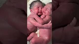 Twin birth 😍😍#junior #shorts #shortvideo #twinbirth