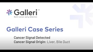 Dr. Poliak describes a liver cancer case detected by the Galleri test