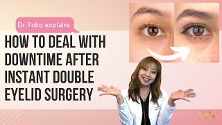 How to deal with downtime after Instant double eyelid surgery