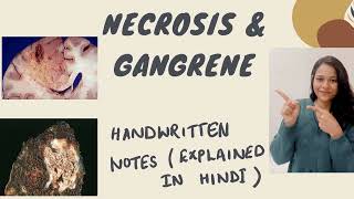 NECROSIS ( Types) & GANGRENE || PATHOLOGY|| In Hindi, ( PART II)