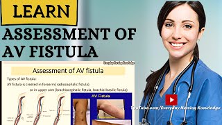 Assessment Of AV Fistula I Everyday Nursing Knowledge