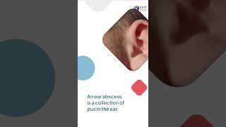 Ear infection and ear abscess treatment in Kandy| 0777567566👍#ear #earinfection #earache 👍🌟