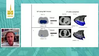 ISICEM, Monitoring, New developments in electrical impedance tomography，Marcelo Amato, Brazil