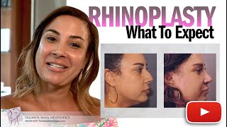 Rhinoplasty - What to expect from Dr. Sinha - Atlanta's #1 Rhinoplasty Surgeon