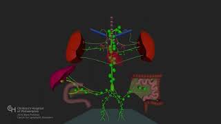 Understanding Plastic Bronchitis