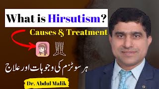 Hirsutism | Unwanted hair growth in females | Male pattern hair growth in females