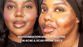 NO FOUNDATION Makeup Routine on Acne Scarring and Hyperpigmentation#acnescars  #nofoundationmakeup