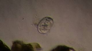 Nematode Egg is Being Attacked by Bacteria