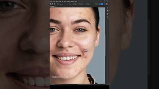 Fastest way to remove acne in Photoshop #photoshop #photoshoptutorial