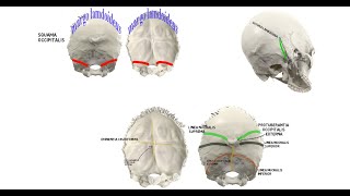 part 4 oss occipitalis