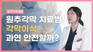 [원추각막 Part 3] 원추각막 치료법! 각막이식, 과연 안전할까?  | Keratoconus