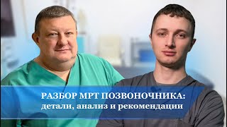 Разбор МРТ позвоночника: детали, анализ и рекомендации.