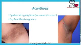 5-Dermatologic Microscopic Terms 1