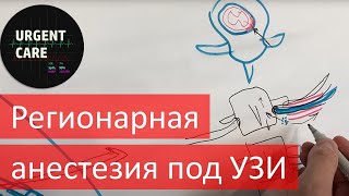 Регионарная анестезия под УЗИ. ESP