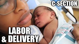 MY LABOR AND DELIVERY STORY | C SECTION & BREECH BABY