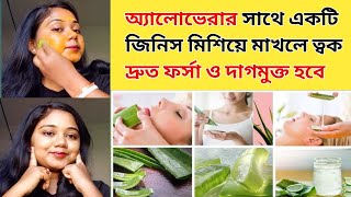 অ্যালোভেরা এভাবে লাগলে ত্বক হবে ফর্সা মসৃন ও চকচকে | Aloe vera for Glowing skin | remove dark spots