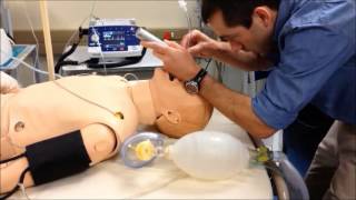 RSI part 3: Intubation