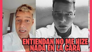 Ricky Martin sale a aclarar rumores sobre su  operación