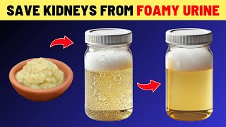 Top 15 SuperFoods To Stop Proteinuria Fast and Heal Your Kidneys Quickly! | VisitJoy