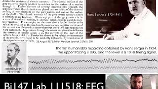 Bi147 111518: Lab 11. EEG