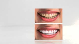 Dentist In Naperville IL | Maple Park Dental Care Naperville | (630) 687-9200