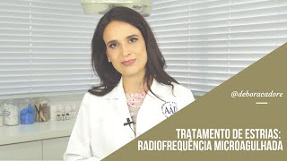 Tratamento de estrias: Radiofrequência Microagulhada