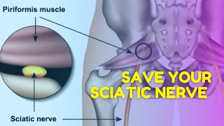 Protect your Sciatic nerve with better Butt Muscle coverage no cap #shorts #youtubeshorts