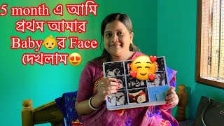 5 month এ আমি প্রথম আমার baby👶র face দেখলাম😍#pregnancy#pregnancyvlog#pregnancyvideo#babyfacereveal