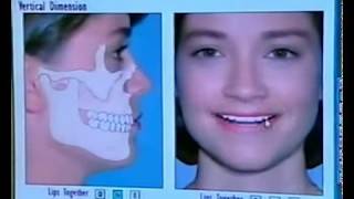 Alternatives to Extraction Orthodontics