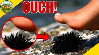 If You Step On This Sea Creature, Get Help Immediately!