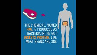 Cleveland Clinic researchers discover a gut-microbe metabolite linked to cardiovascular disease.