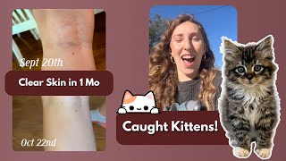 1 Month Eczema Transformation, Feral Kittens & Hiking Fails!