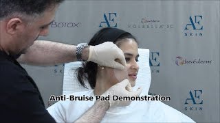 Anti-Bruise Pad Demonstration 3 - A E Skin - Encino, CA - 818-835-1833