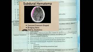 epidural vs subdural hematoma|Fcps part-1 preparation forum| CPSP FAVOURITE QUESTIONS