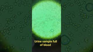 This is what blood looks like under microscope (RBC)